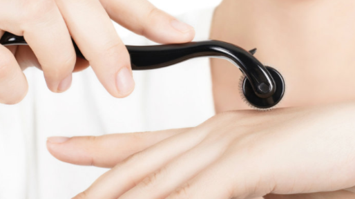 Microneedling