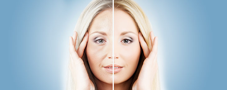 Chirurgie esthétique du visage