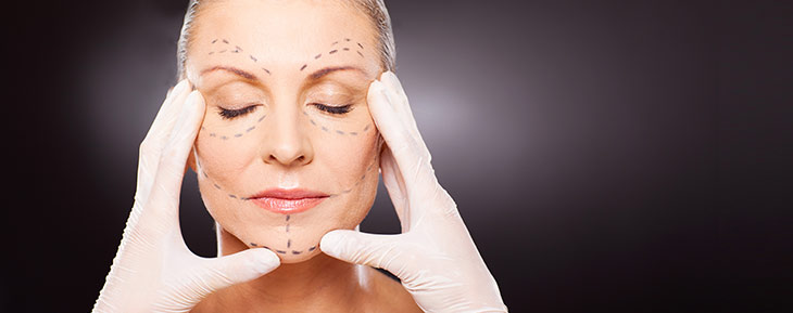 Lifting cervico-facial