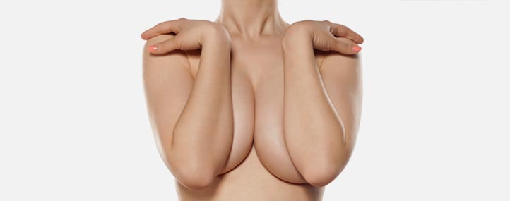 réduction seins trop gros